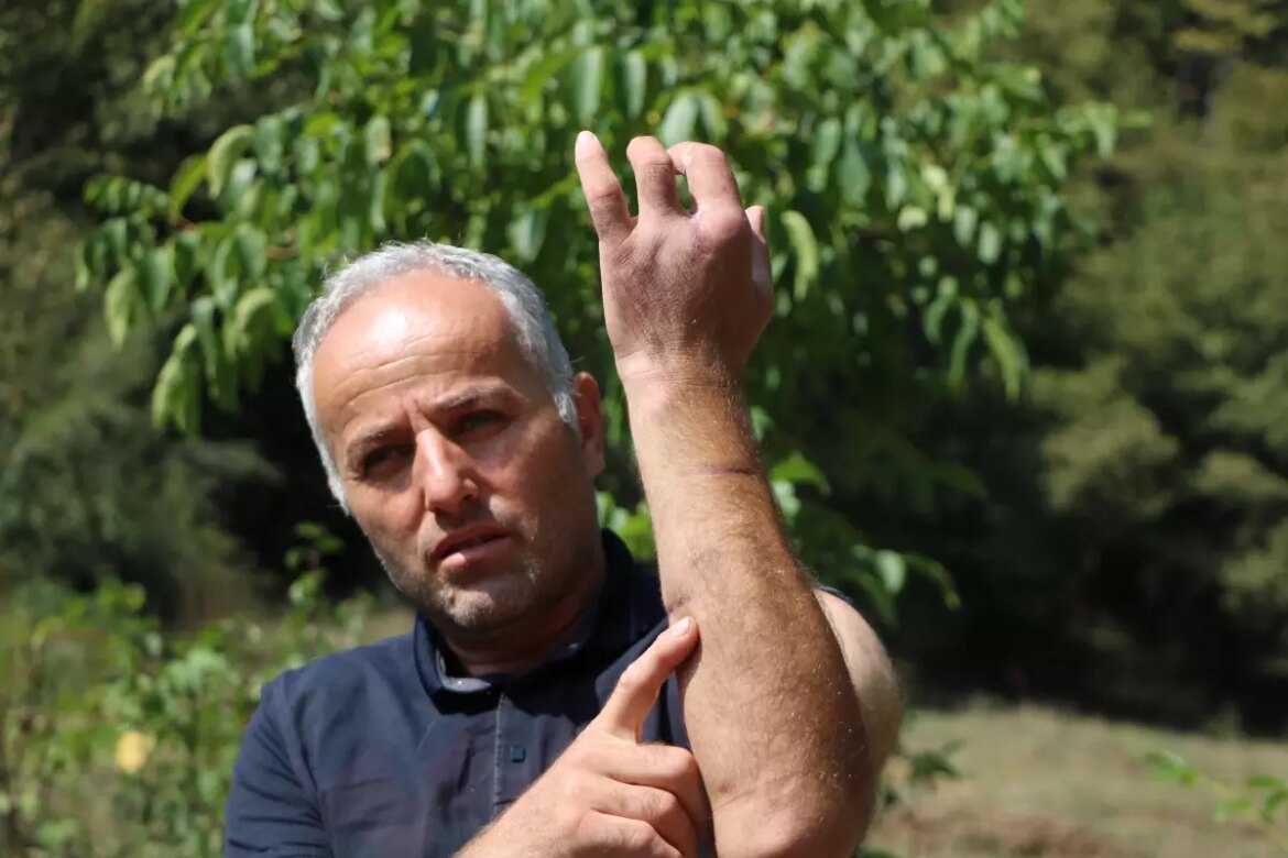 boluda-ayi-akininda-bir-kisi-yaralandi-XFbckGM3.jpg